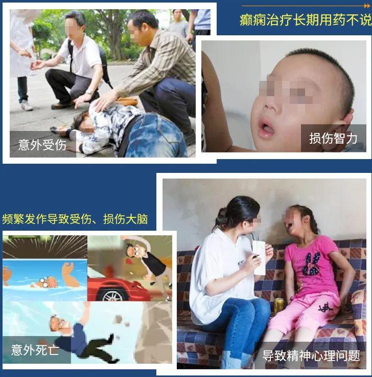 揭秘最新癫痫治疗方法，你了解多少？