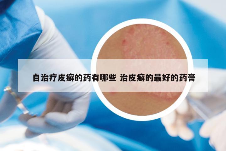 皮癣最新药，自然美景中的治愈之旅