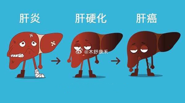 肝硬化最新治疗方法,健康福音来临!